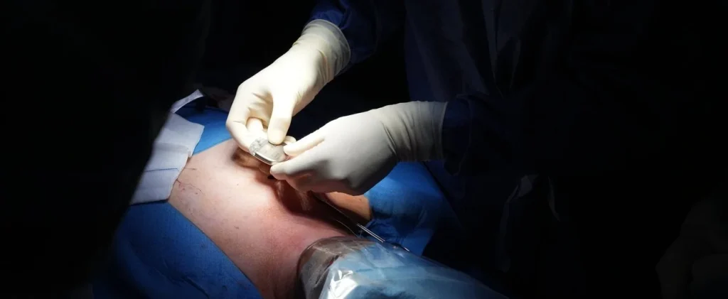 #Apnée 3.0 : un #Implant sous-cutané #Connecté au #Chu #Toulouse